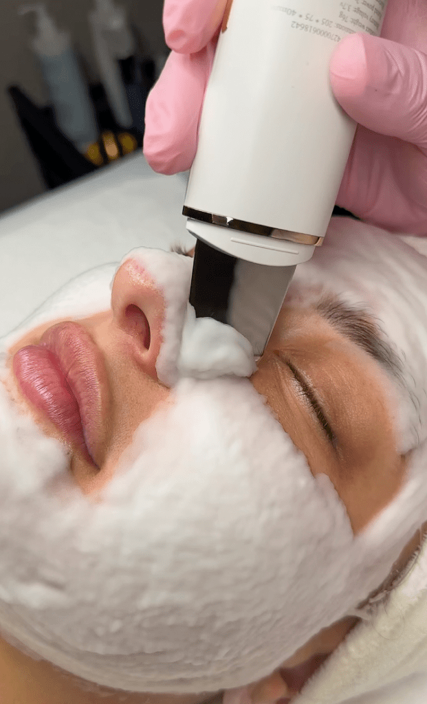 Giluminis valymas, IG @tayloredbeauty.il | Treatwell