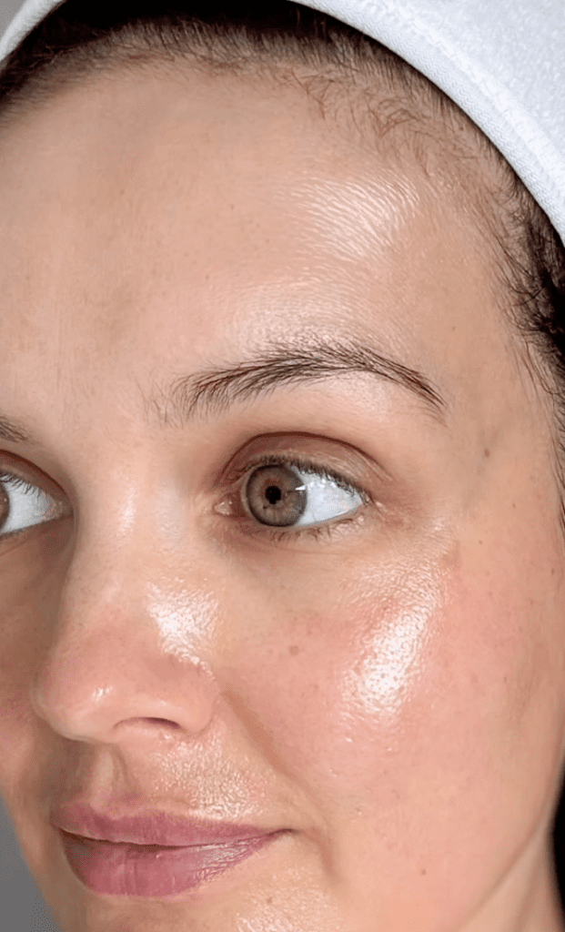 Vitamino C pilingas, IG @skincarebyjoanne | Treatwell